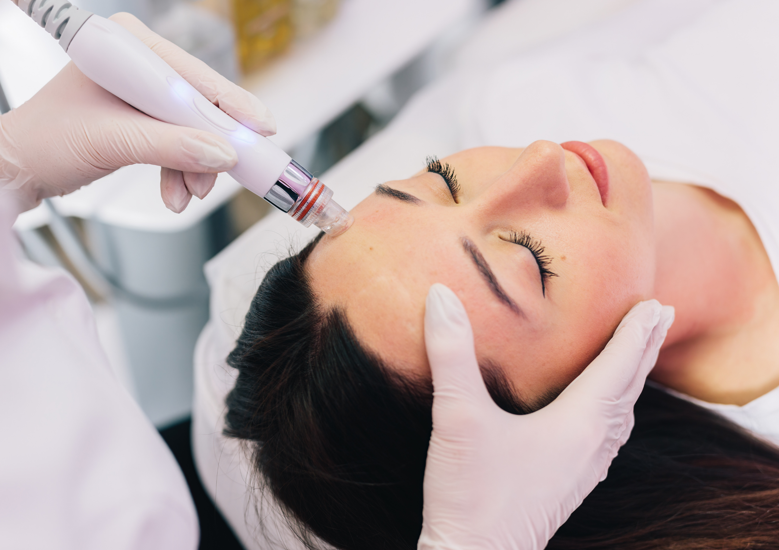 Close-up of a practitioner in gloves using a handheld device on a patient’s cheek during a facial treatment.